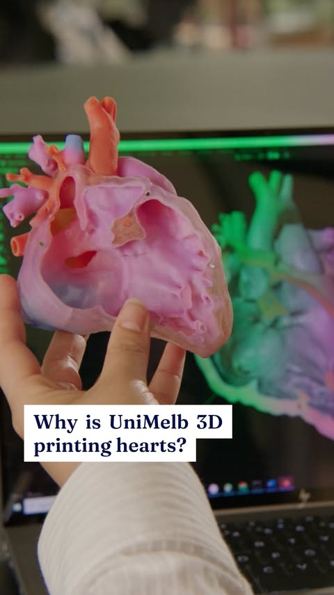 🫀 UniMelb design experts and The Royal Children’s Hospital (RCH) heart specialists have collaborated to create the world’s first anatomically accurate set of three-dimensional paediatric heart models. The innovative …