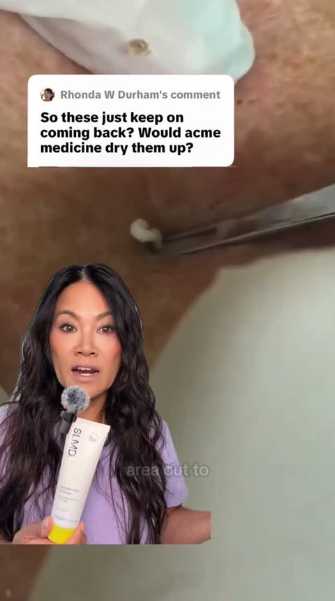 🛑 Stop trying to dry out your blackheads!⁠ ⁠ Derm tip from Dr. Sandra Lee (aka Dr. Pimple Popper), stripping your skin won’t clear it. Dry or oily, your skin needs moisture to work its best. ⁠ ⁠ ✨ Our SLMD Salicylic …