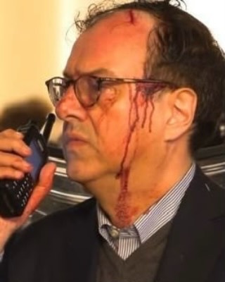 A volto scoperto, ferito, senza arretrare. Davanti a lui, chi si nasconde dietro un cappuccio per colpire e distruggere. Lo Stato non è un concetto astratto. È fatto di persone che, con coraggio e senso del dovere, re…