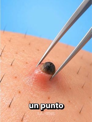 ¿Porque te salen los puntos negros? 😳 #SabiasQue #homosapienstv