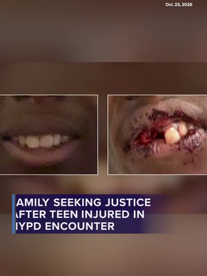 A Staten Island family and local NAACP leaders are calling for the release of police body camera footage and multiple investigations following an encounter between NYPD officers and a 17-year-old boy on Oct. 7 in the …
