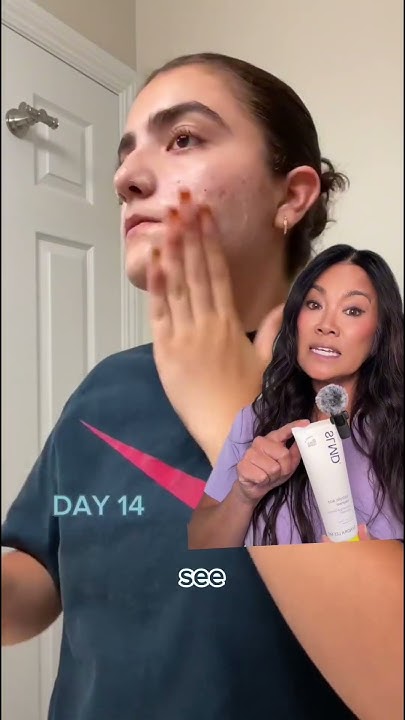 Is this Salicylic Acid Cleanser really worth the hype? #drpimplepopper #skincareproducts #skintips